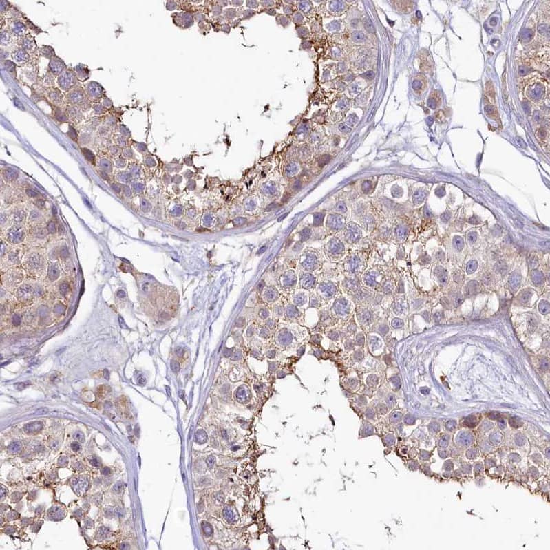 Immunohistochemistry-Paraffin SH3TC2 Antibody - BSA Free