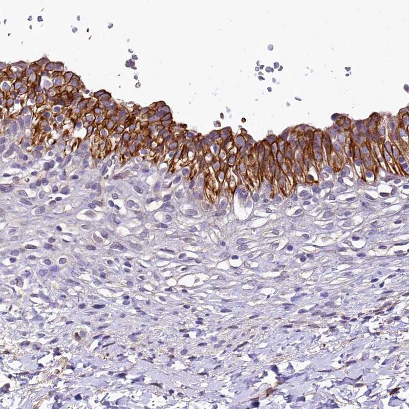 Immunohistochemistry-Paraffin SH3TC2 Antibody - BSA Free