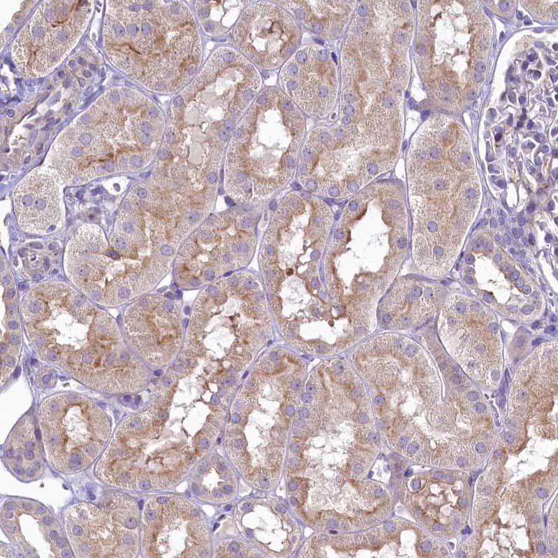Staining of human kidney shows weak membranous and cytoplasmic positivity in cells in tubules.