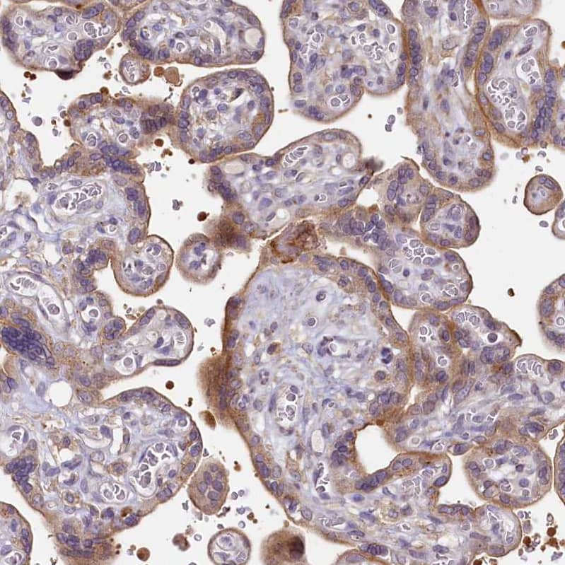 Staining of human placenta shows weak to moderate membranous and cytoplasmic positivity in trophoblastic cells.