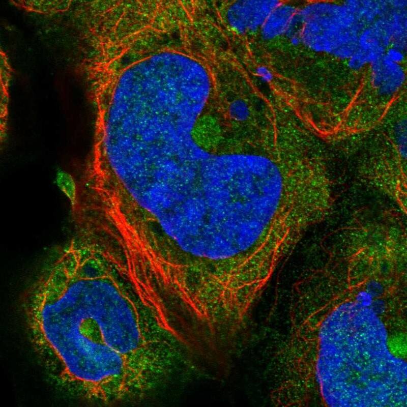 Staining of human cell line HEK 293 shows localization to cytosol & aggresome.