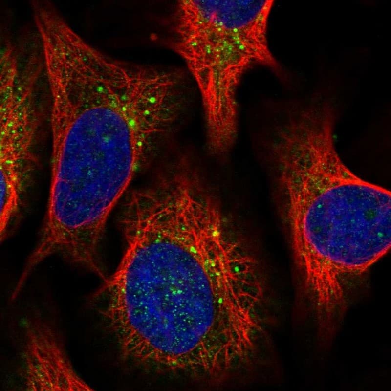 Staining of human cell line U-2 OS shows localization to vesicles.