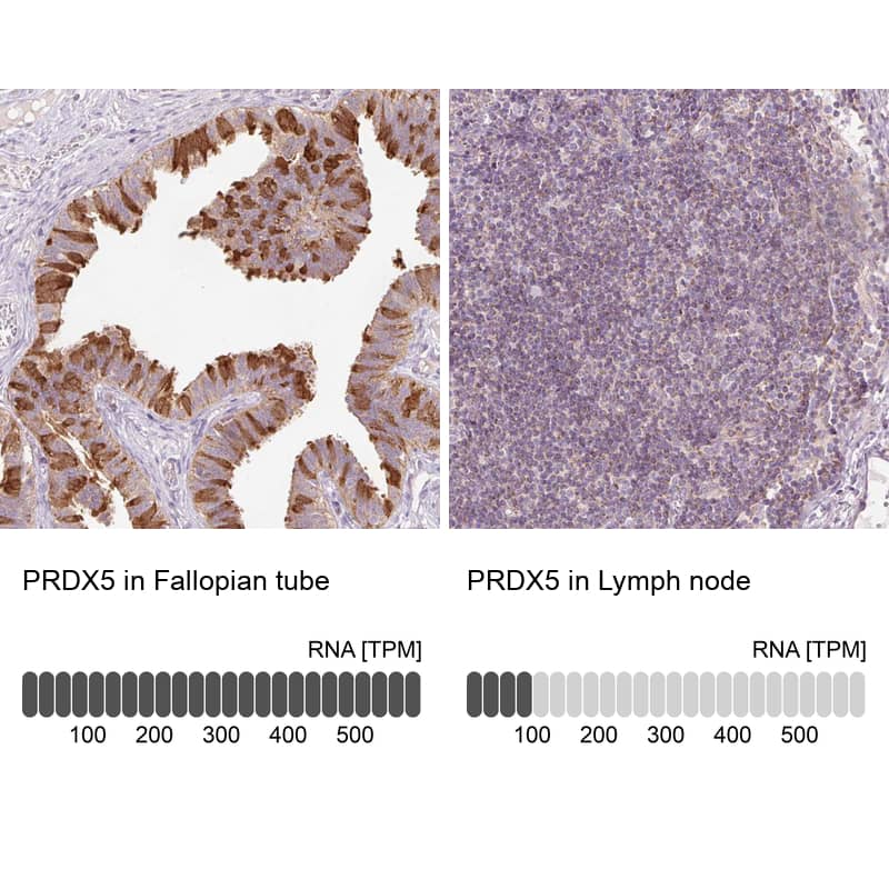 Immunohistochemistry-Paraffin Peroxiredoxin 5 Antibody - BSA Free