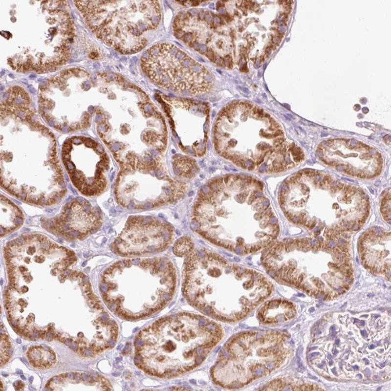 Staining of human kidney shows strong cytoplasmic positivity in cells in tubules.