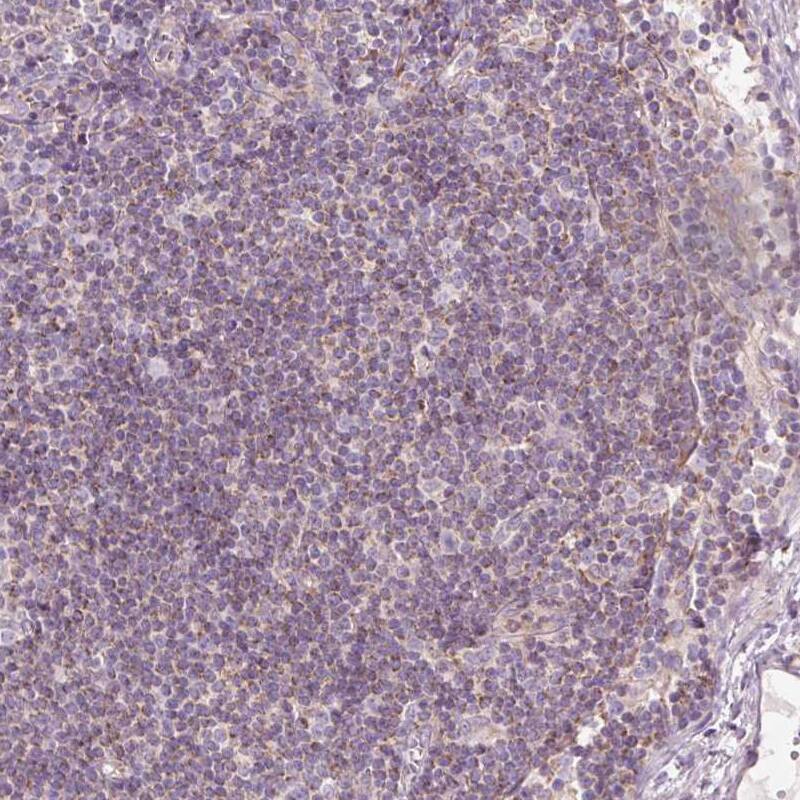 Staining of human lymph node shows negative to very weak cytoplasmic positivity in non-germinal center cells.