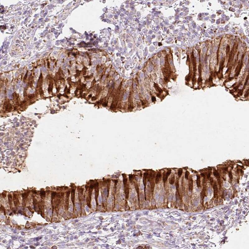 Staining of human bronchus shows strong cytoplasmic positivity in respiratory epithelial cells.
