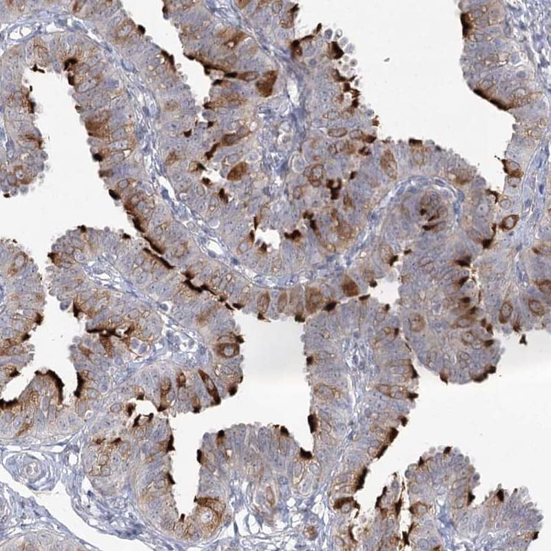 Staining of human fallopian tube shows strong positivity in cilia.