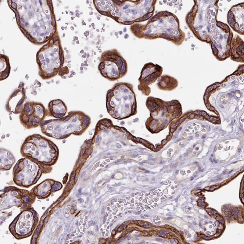 Staining of human placenta shows cytoplasmic and membranous positivity in trophoblastic cells.