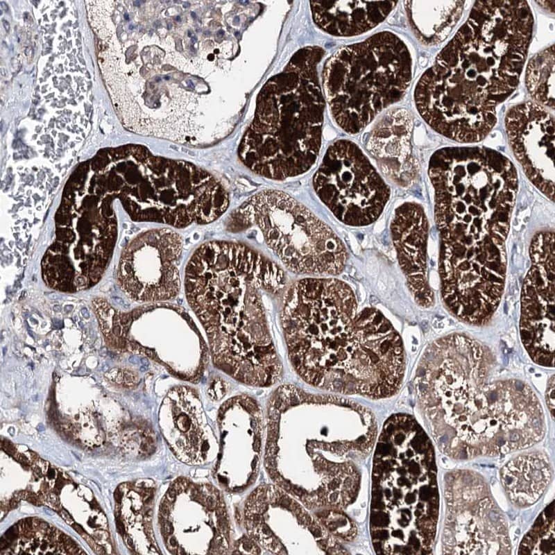 Staining of human kidney shows strong cytoplasmic positivity in cells in tubules.