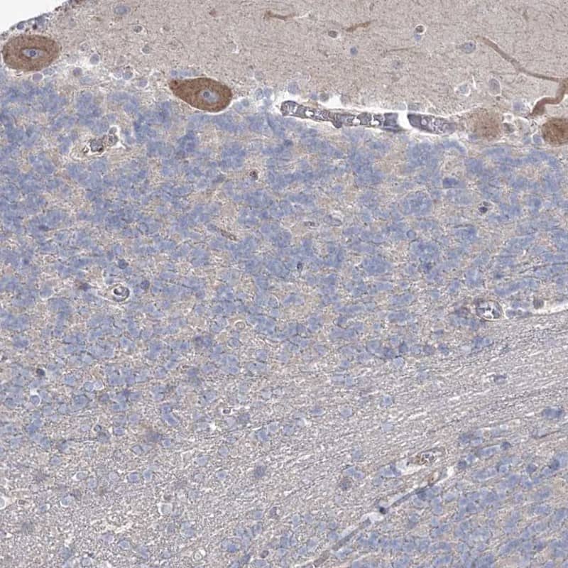 Staining of human cerebellum shows moderate cytoplasmic positivity in Purkinje cells.