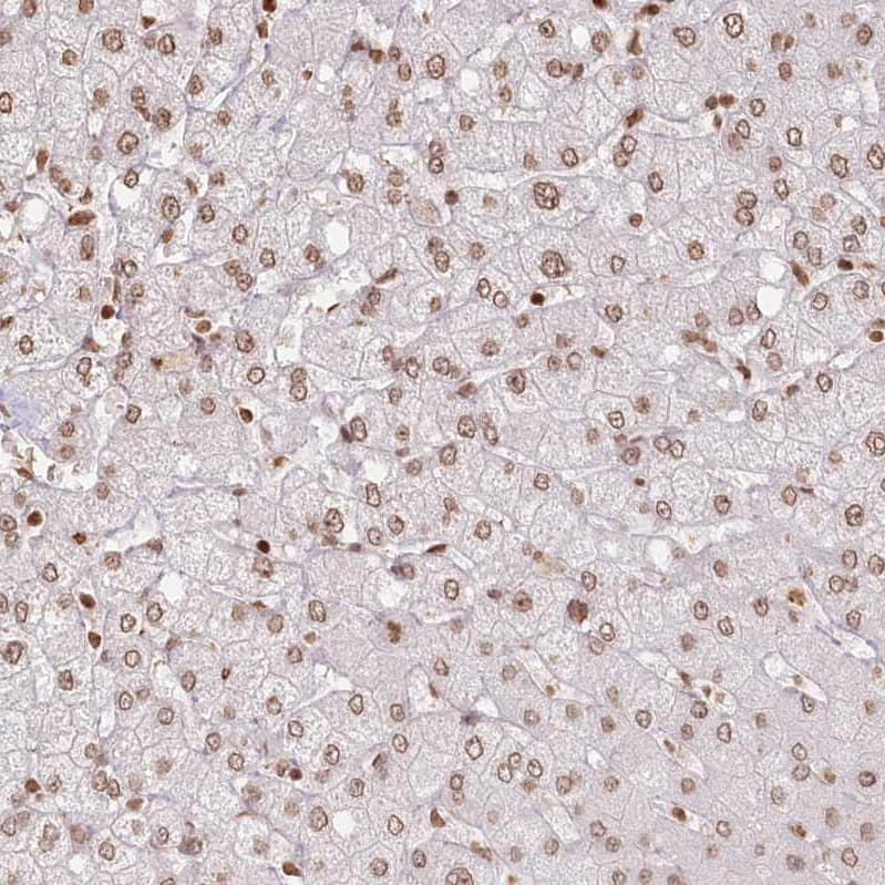 Staining of human liver shows weak to moderate nuclear positivity in hepatocytes.