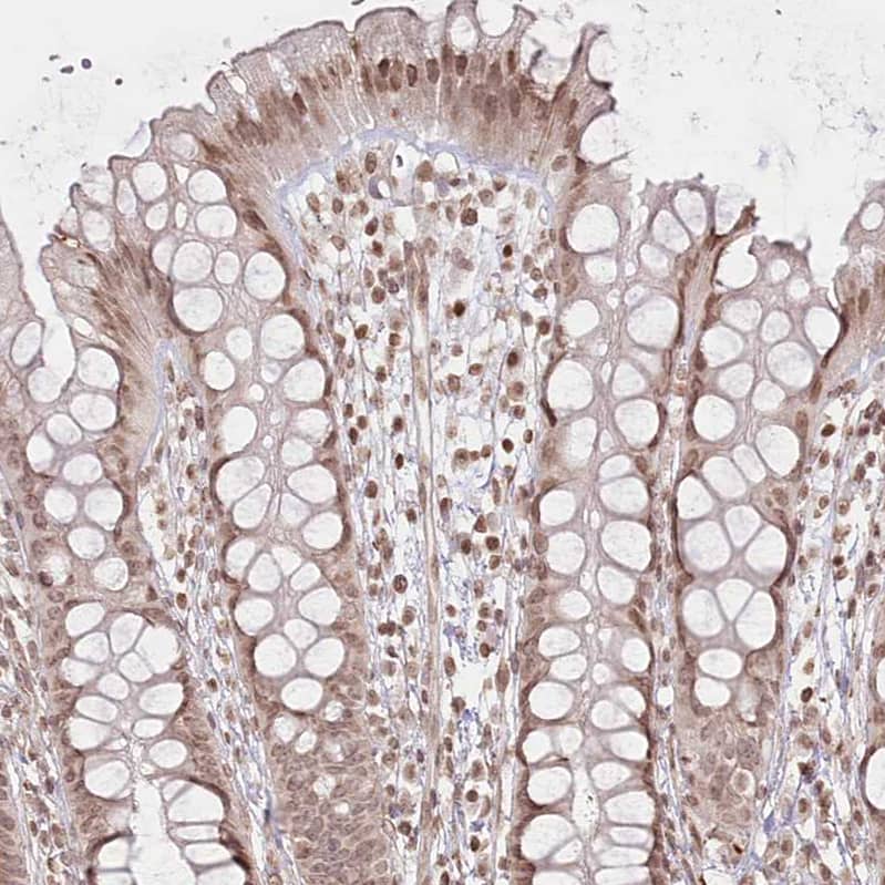 Staining of human rectum shows weak to moderate nuclear positivity in glandular cells.