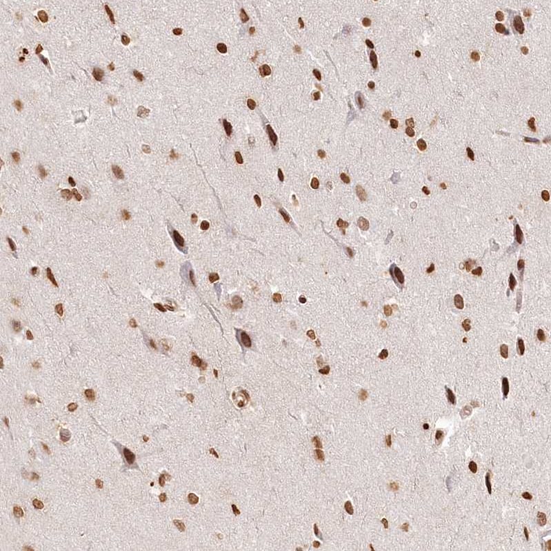 Staining of human cerebral cortex shows strong nuclear positivity in neurons and glial cells.