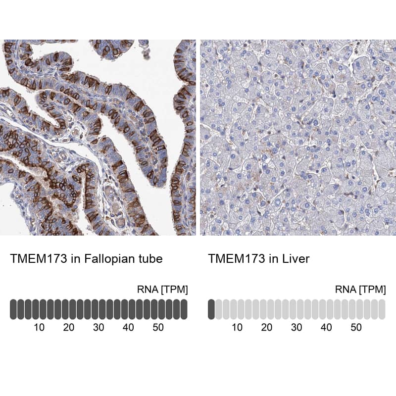 <b>Orthogonal Strategies Validation. </b>Analysis in human fallopian tube and liver tissues. Corresponding RNA-seq data are presented for the same tissues.