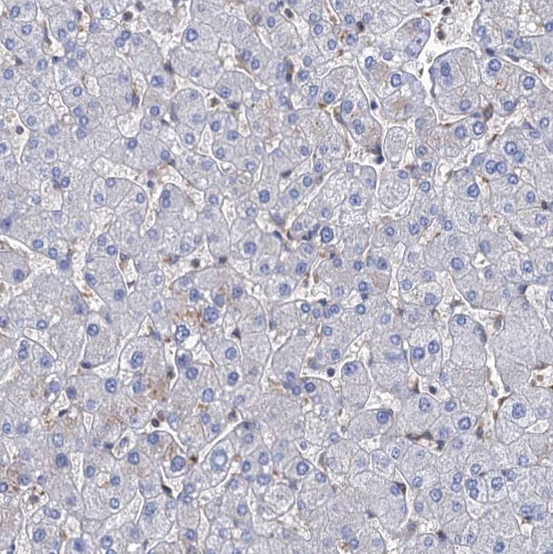 Staining of human liver shows no positivity in hepatocytes as expected.