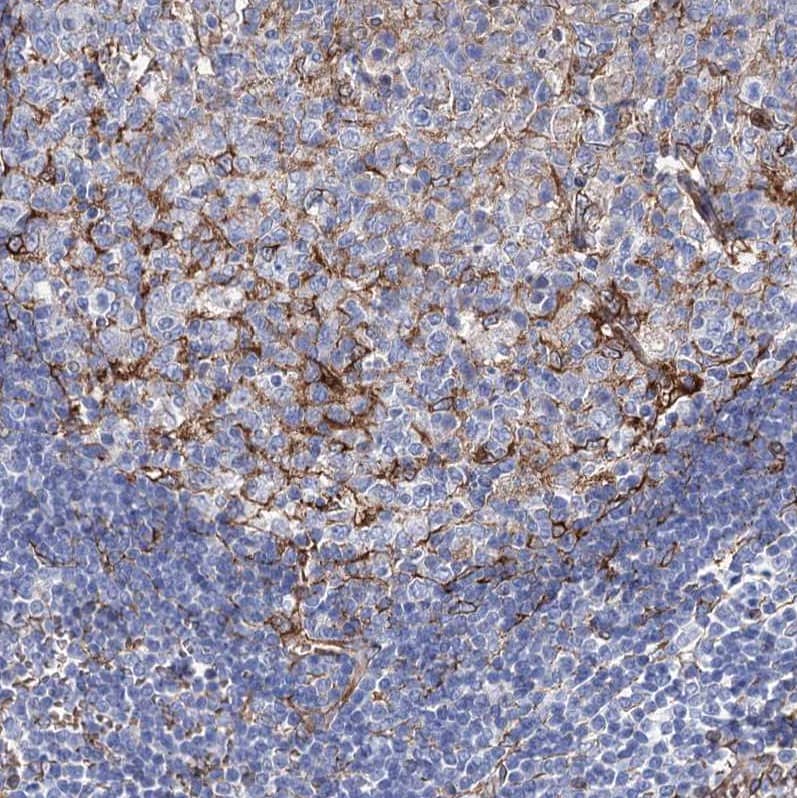 Staining of human lymph node shows strong membranous positivity in follicular dendritic cells.