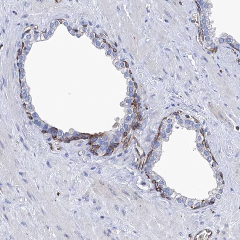 Staining of human prostate shows moderate membranous positivity in basal layer glandular cells.