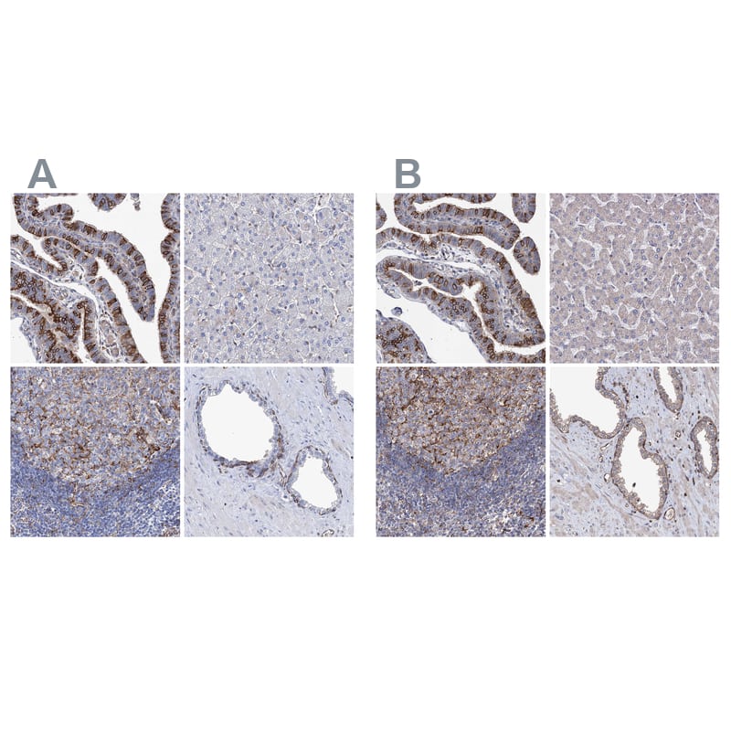 <b>Orthogonal Strategies Validation. </b>Staining of human fallopian tube, liver, lymph node and prostate HPA038116 (A) shows similar protein distribution across tissues to independent antibody HPA038534 (B).
