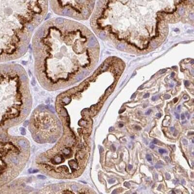 Staining of human kidney.