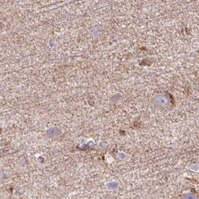 Staining of human cerebral cortex.
