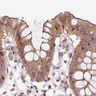 Staining of human colon.