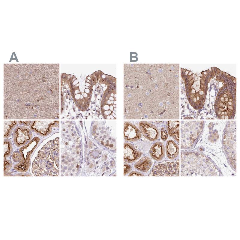 <b>Orthogonal Strategies Validation. </b>Staining of human cerebral cortex, colon, kidney and testis HPA038135 (A) shows similar protein distribution across tissues to independent antibody HPA038136 (B).