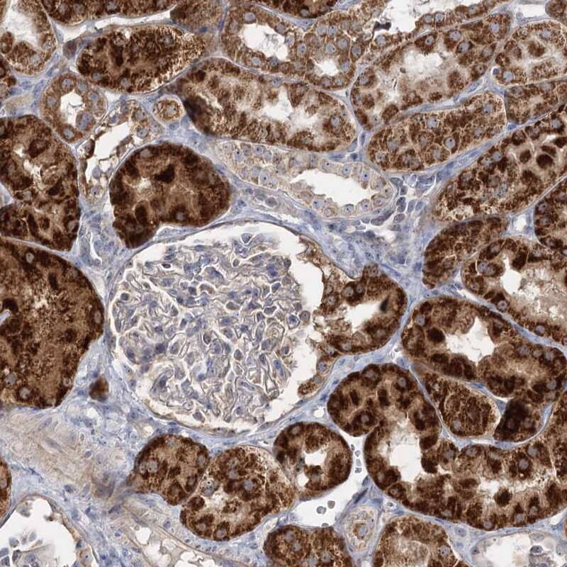 <b>Independent Antibodies Validation. </b>Staining of human kidney shows strong cytoplasmic positivity in cells in tubules.