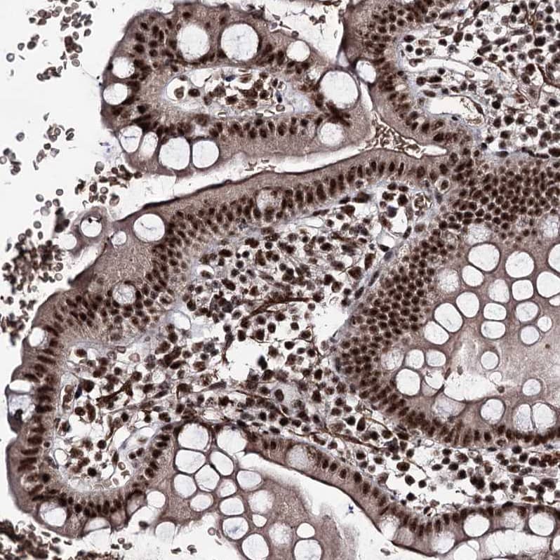 Staining of human small intestine shows strong nuclear positivity in glandular cells.