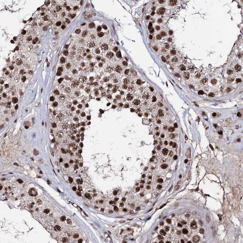 Staining of human testis shows strong nuclear positivity in cells in seminiferous ducts.