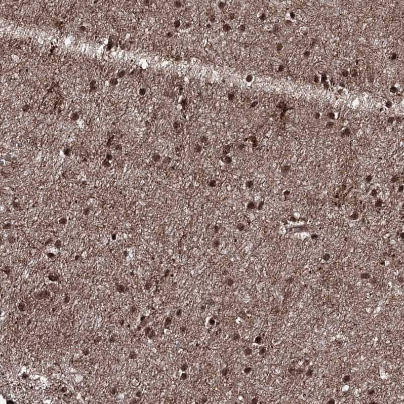 Staining of human cerebral cortex shows strong nuclear positivity in neuronal cells.