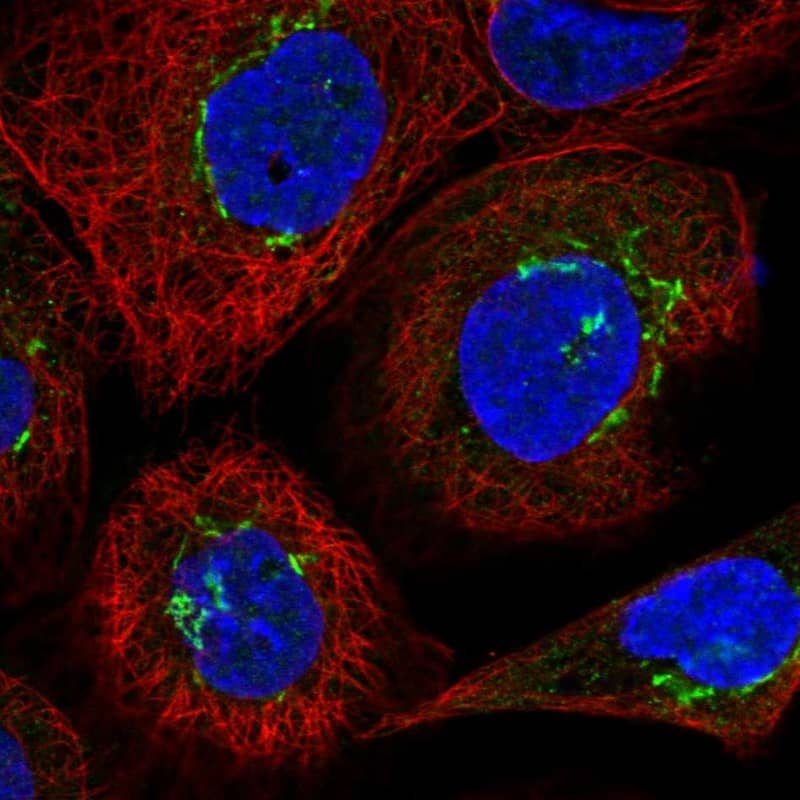 Staining of human cell line A-431 shows localization to the Golgi apparatus.