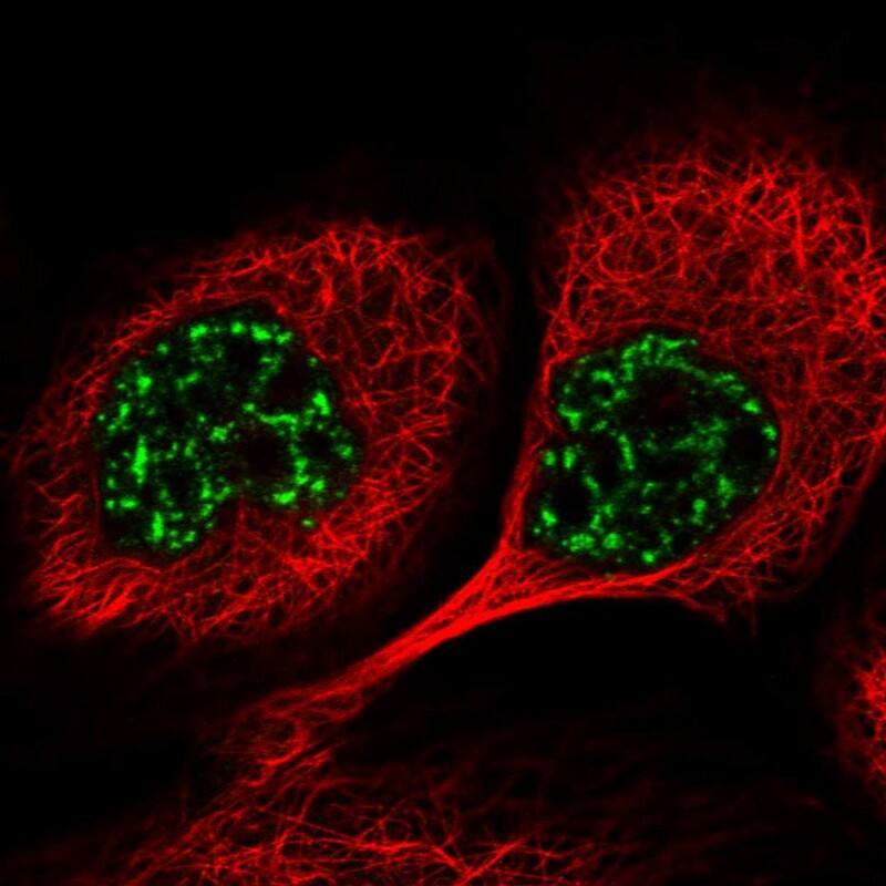 Staining of human cell line A-431 shows localization to nuclear speckles.