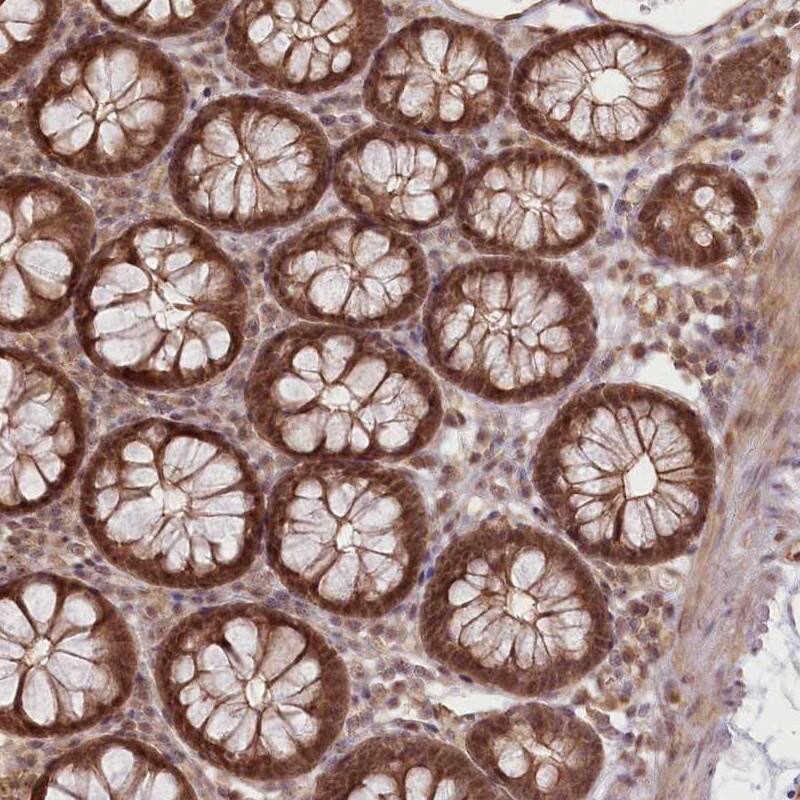 Staining of human colon shows strong cytoplasmic and nucleolar/ or nuclear positivity in glandular cells.