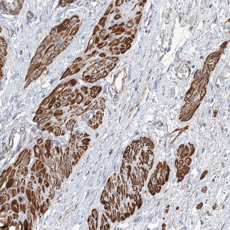 Staining of human smooth muscle shows strong cytoplasmic positivity in smooth muscle cells.