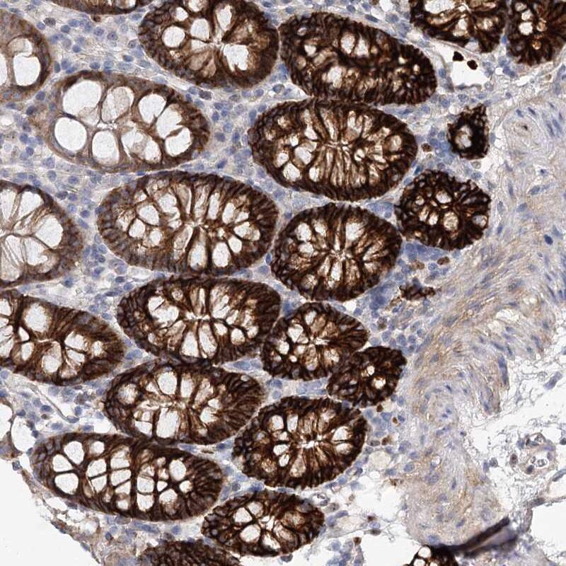 Staining of human colon shows strong cytoplasmic and membranous positivity in glandular cells.