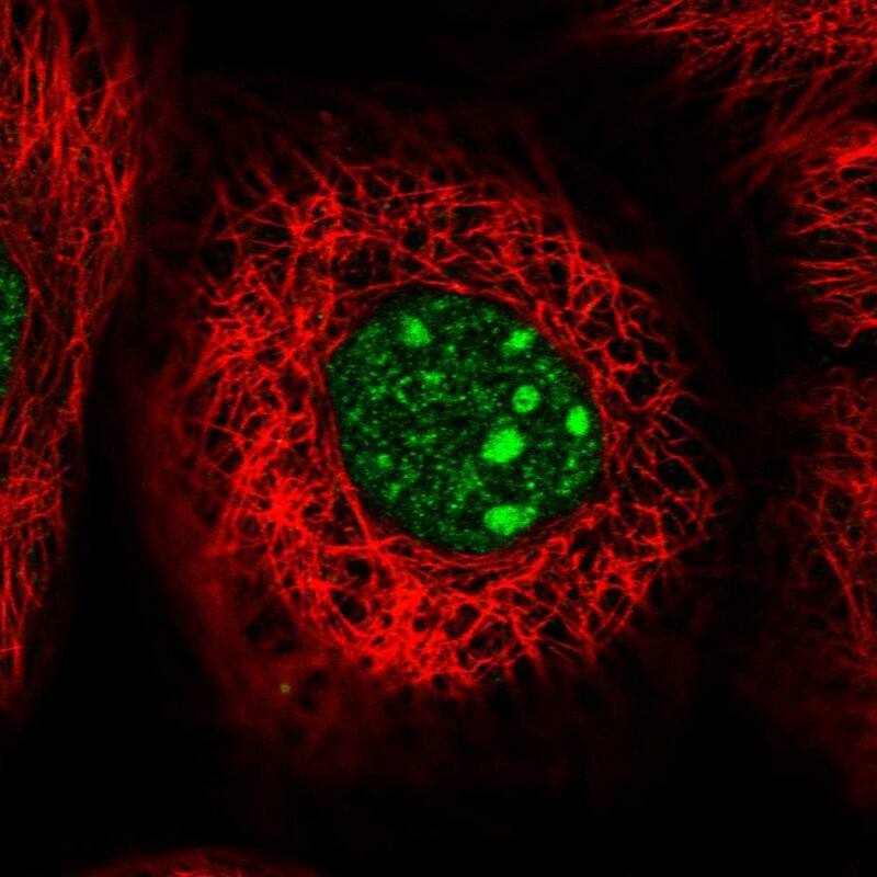 Staining of human cell line A-431 shows localization to nucleus & nucleoli.