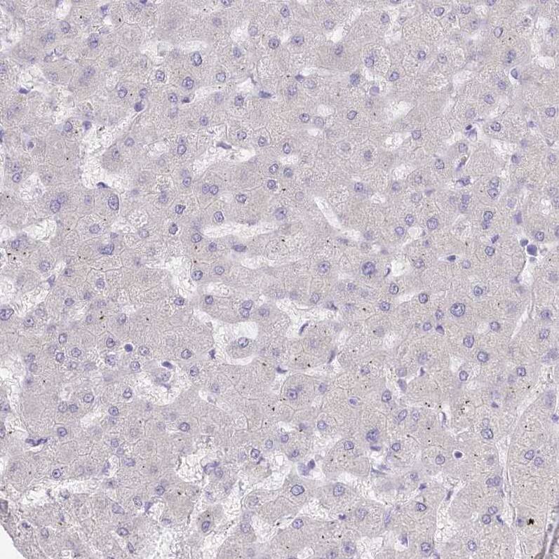 Immunohistochemistry-Paraffin Myozenin 1 Antibody - BSA Free