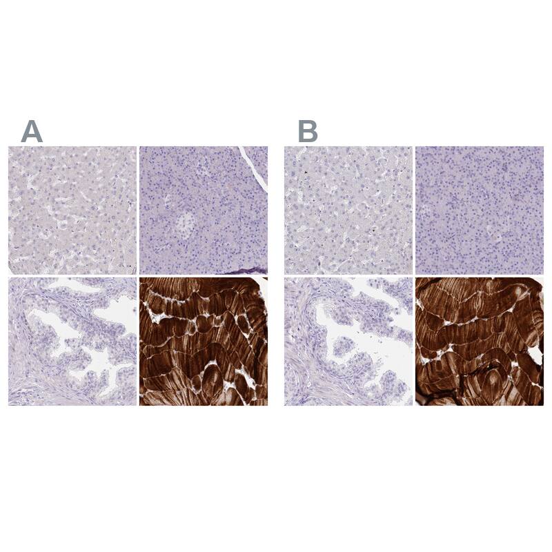 Immunohistochemistry-Paraffin Myozenin 1 Antibody - BSA Free