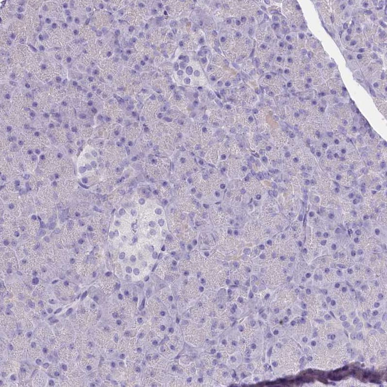Immunohistochemistry-Paraffin Myozenin 1 Antibody - BSA Free