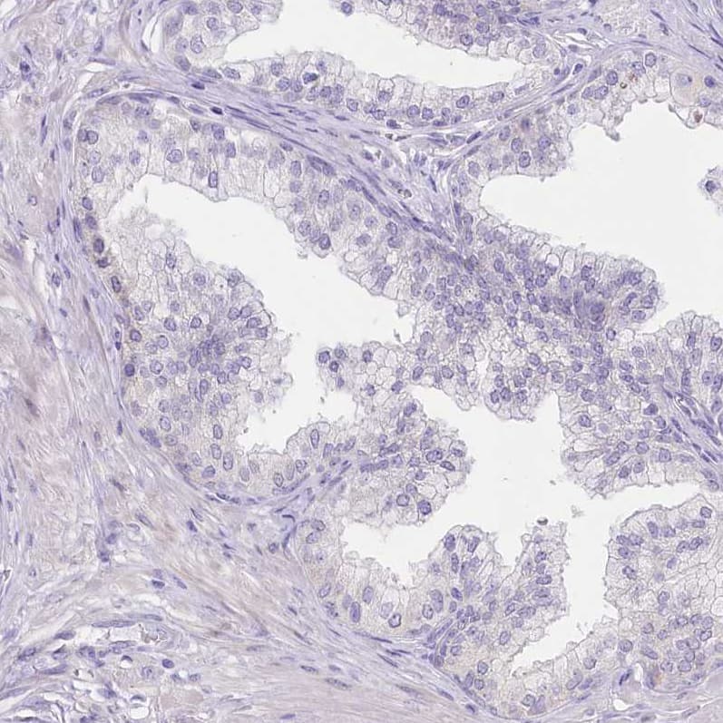 Immunohistochemistry-Paraffin Myozenin 1 Antibody - BSA Free