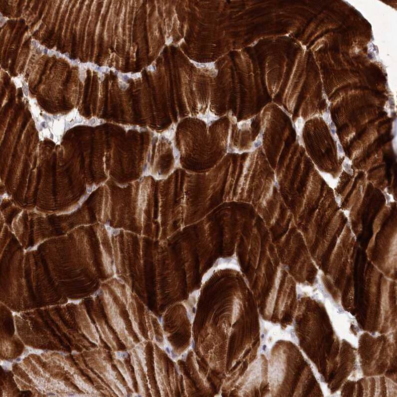 Immunohistochemistry-Paraffin Myozenin 1 Antibody - BSA Free