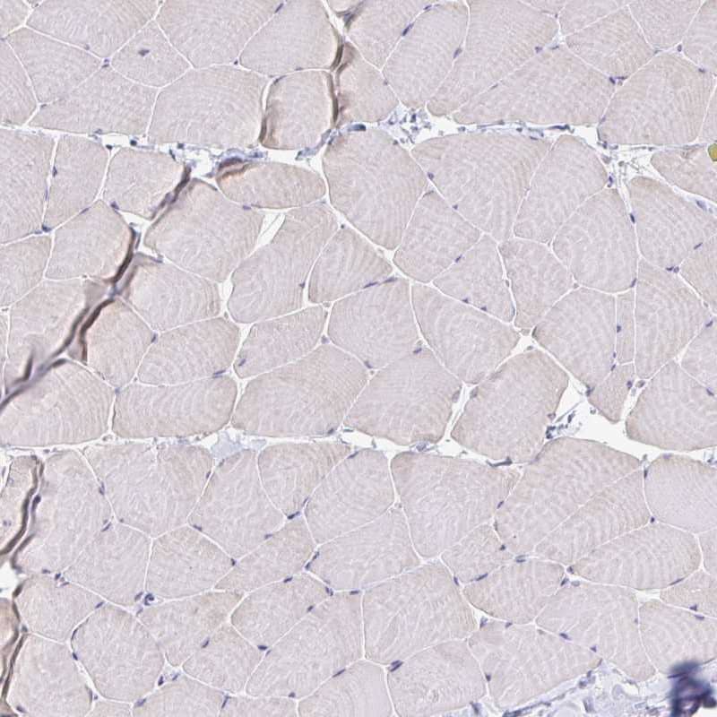 Immunohistochemistry-Paraffin BCAP/PIK3AP1 Antibody - BSA Free