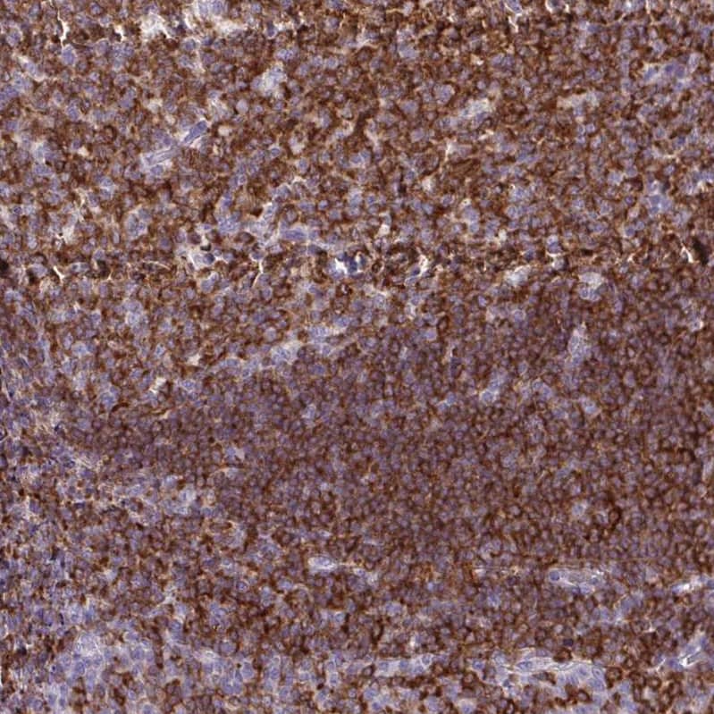 Immunohistochemistry-Paraffin BCAP/PIK3AP1 Antibody - BSA Free