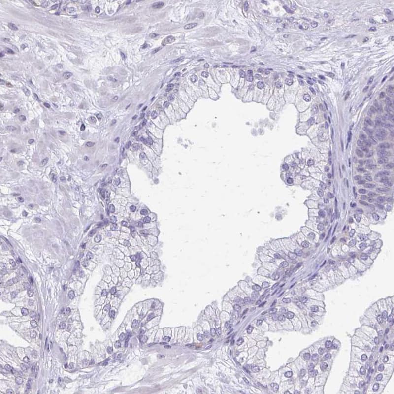 Immunohistochemistry-Paraffin BCAP/PIK3AP1 Antibody - BSA Free
