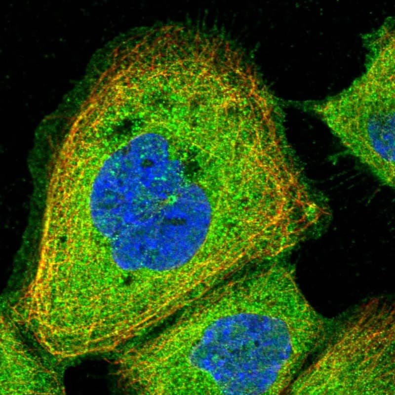 Staining of human cell line A-431 shows localization to plasma membrane & cytosol.