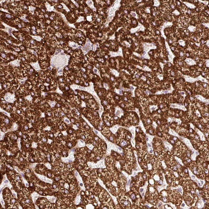 Staining of human liver shows strong cytoplasmic positivity in hepatocytes.
