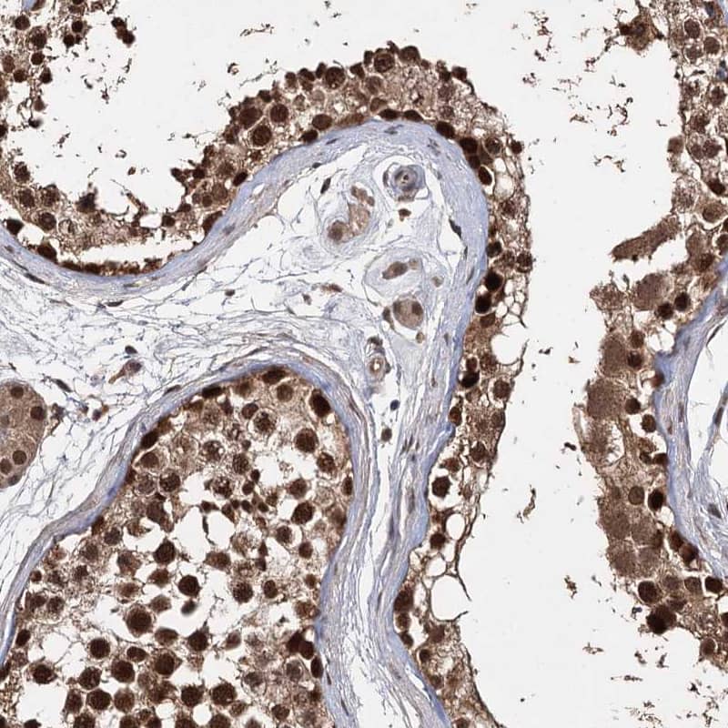 Staining of human testis shows strong nuclear positivity in cells in seminiferous ducts.
