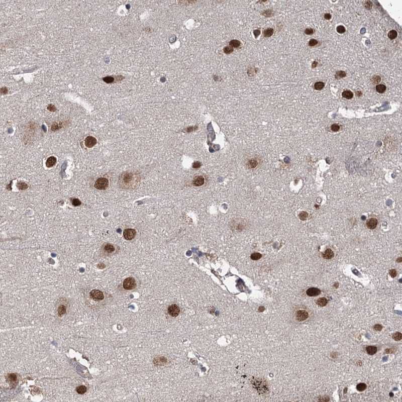 Staining of human cerebral cortex shows strong nuclear positivity in neurons.