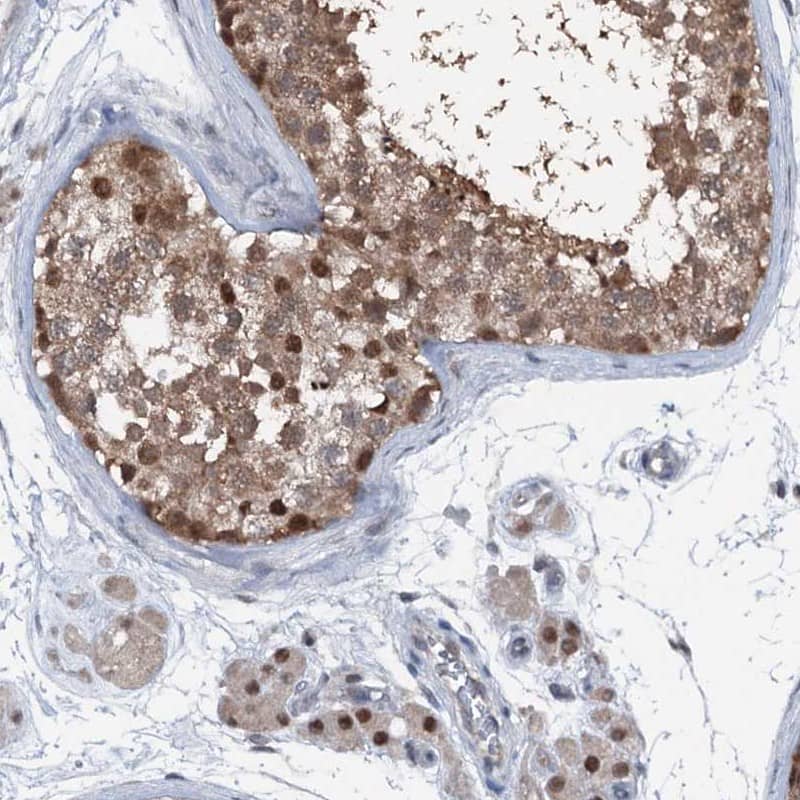 <b>Independent Antibodies Validation. </b>Staining of human testis shows moderate cytoplasmic and nuclear positivity in cells in seminiferous ducts and Leydig cells.