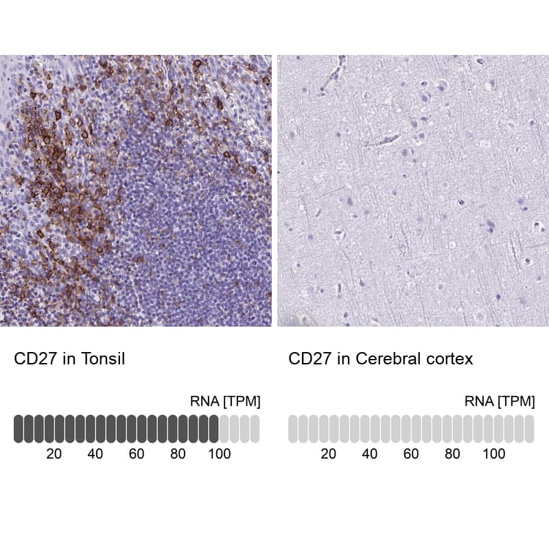 <b>Orthogonal Strategies Validation. </b>Analysis in human tonsil and cerebral cortex tissues.